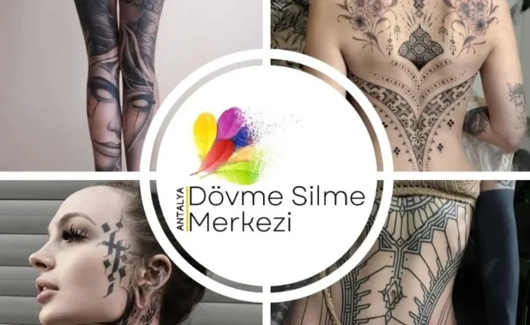 Antalya’da Dövme Sildirme İşlemi Sonrası Cilt Nasıl Tepki Verir?