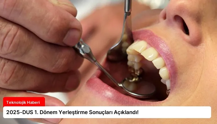 2025-DUS 1. Dönem Yerleştirme Sonuçları Açıklandı!