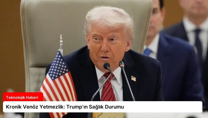 Kronik Venöz Yetmezlik: Trump’ın Sağlık Durumu