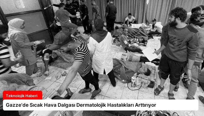 Gazze’de Sıcak Hava Dalgası Dermatolojik Hastalıkları Arttırıyor