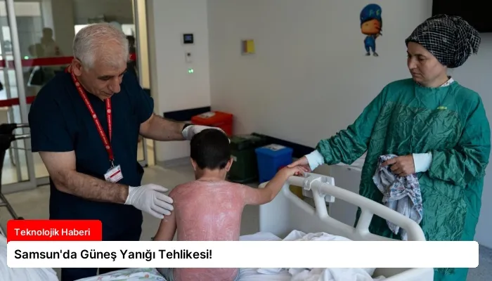 Samsun’da Güneş Yanığı Tehlikesi!