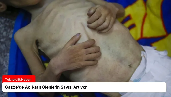 Gazze’de Açlıktan Ölenlerin Sayısı Artıyor