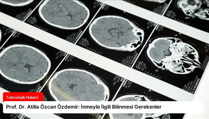 Prof. Dr. Atilla Özcan Özdemir: İnmeyle İlgili Bilinmesi Gerekenler