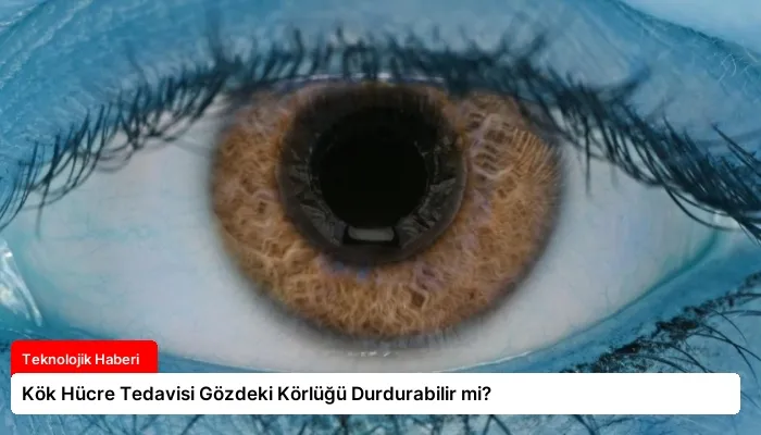 Kök Hücre Tedavisi Gözdeki Körlüğü Durdurabilir mi?